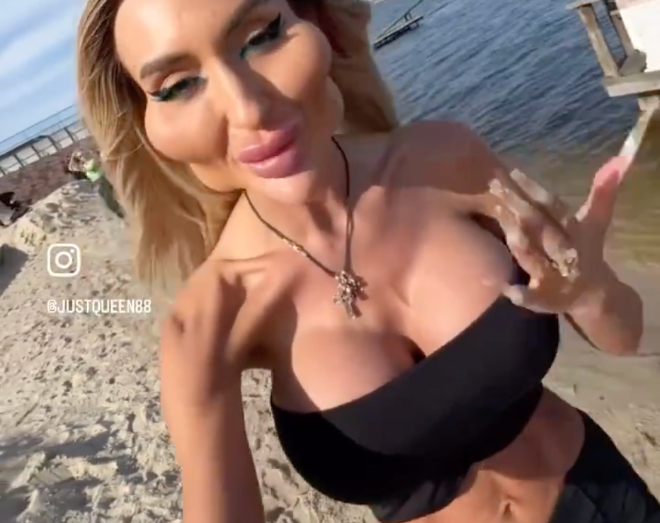 Anastasiia Pokreshch’s 2024 surgical transformation sparks new beauty trends!