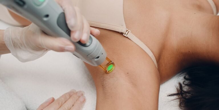 Top 10 Laser Hair Removal Devices for Home Use in 2024