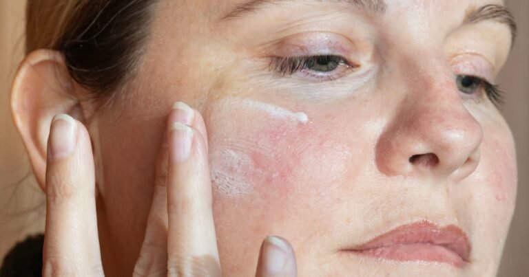 Top 16 Rosacea Products of 2024 Recommended by Experts